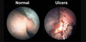 horse stomach ulcer TREAtment